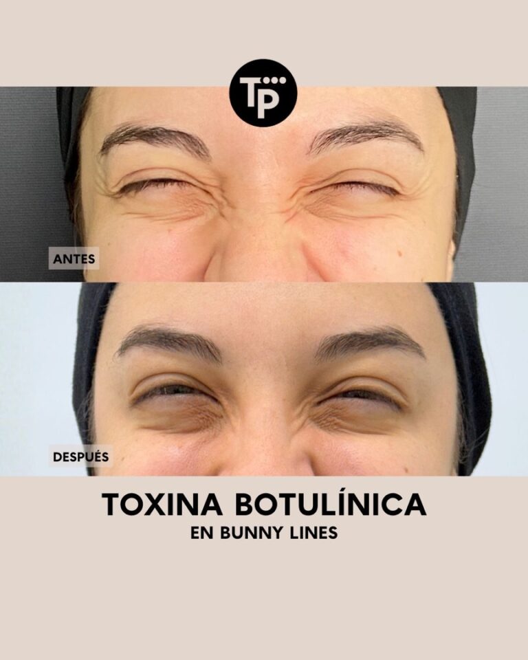 handled_8acccbee-c3e8-4e39-a452-93709911aa63_1080_1920_80