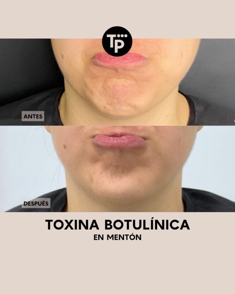 handled_c3f6df15-d98a-4a99-91de-bfb6ed6b81d9_1080_1920_80