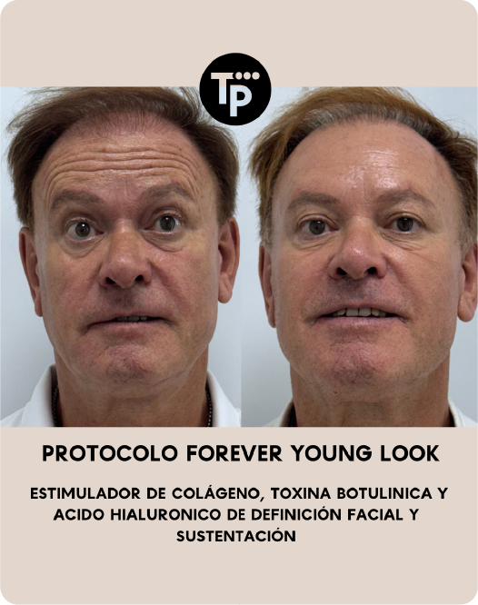 Pacientes Felices Medicina Estetica 6