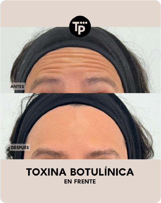 Pacientes Felices Medicina Estetica 9