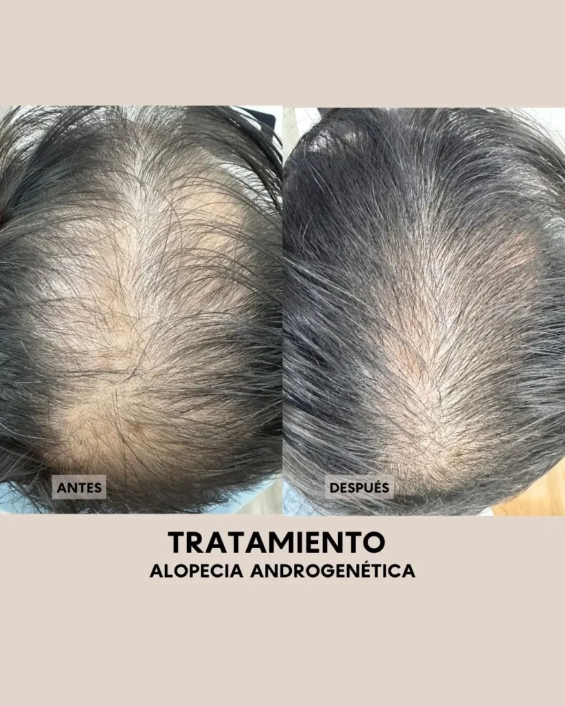 Salud capilar Todo lo que necesitas saber sobre tu cabello 1