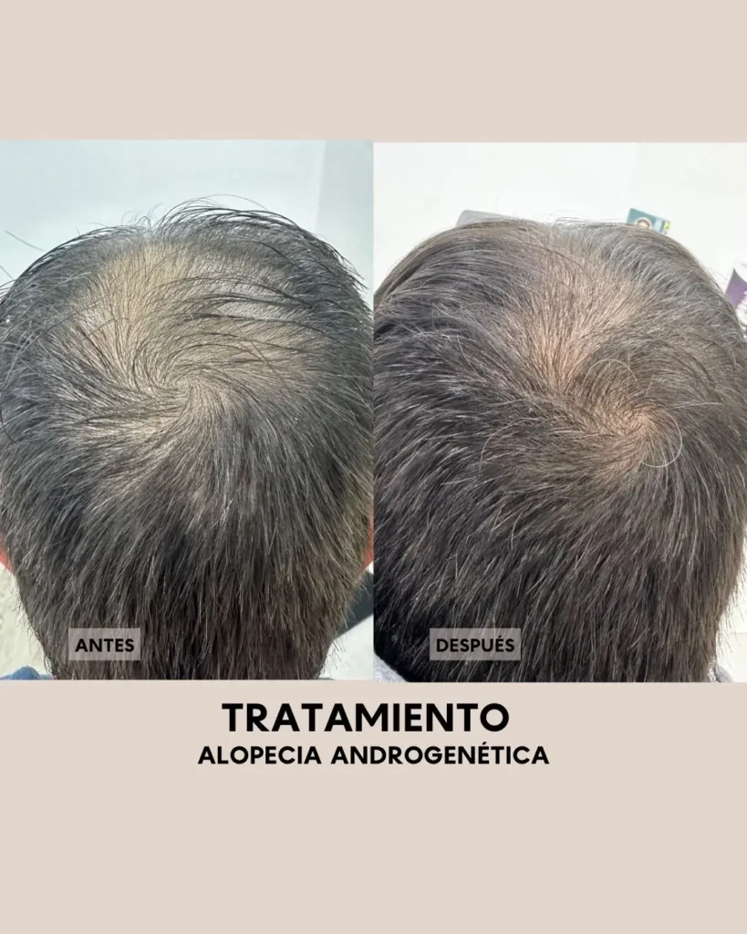 Salud capilar Todo lo que necesitas saber sobre tu cabello 2
